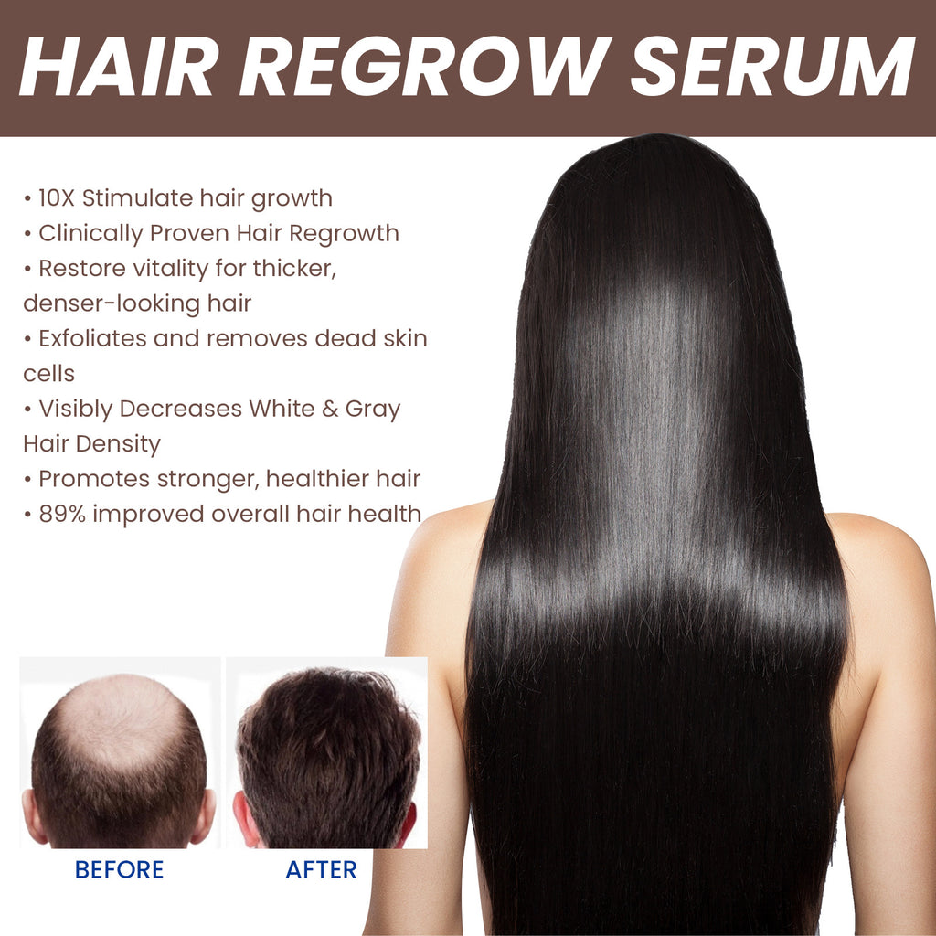 Root Revive Hair Essence by EELHOE
