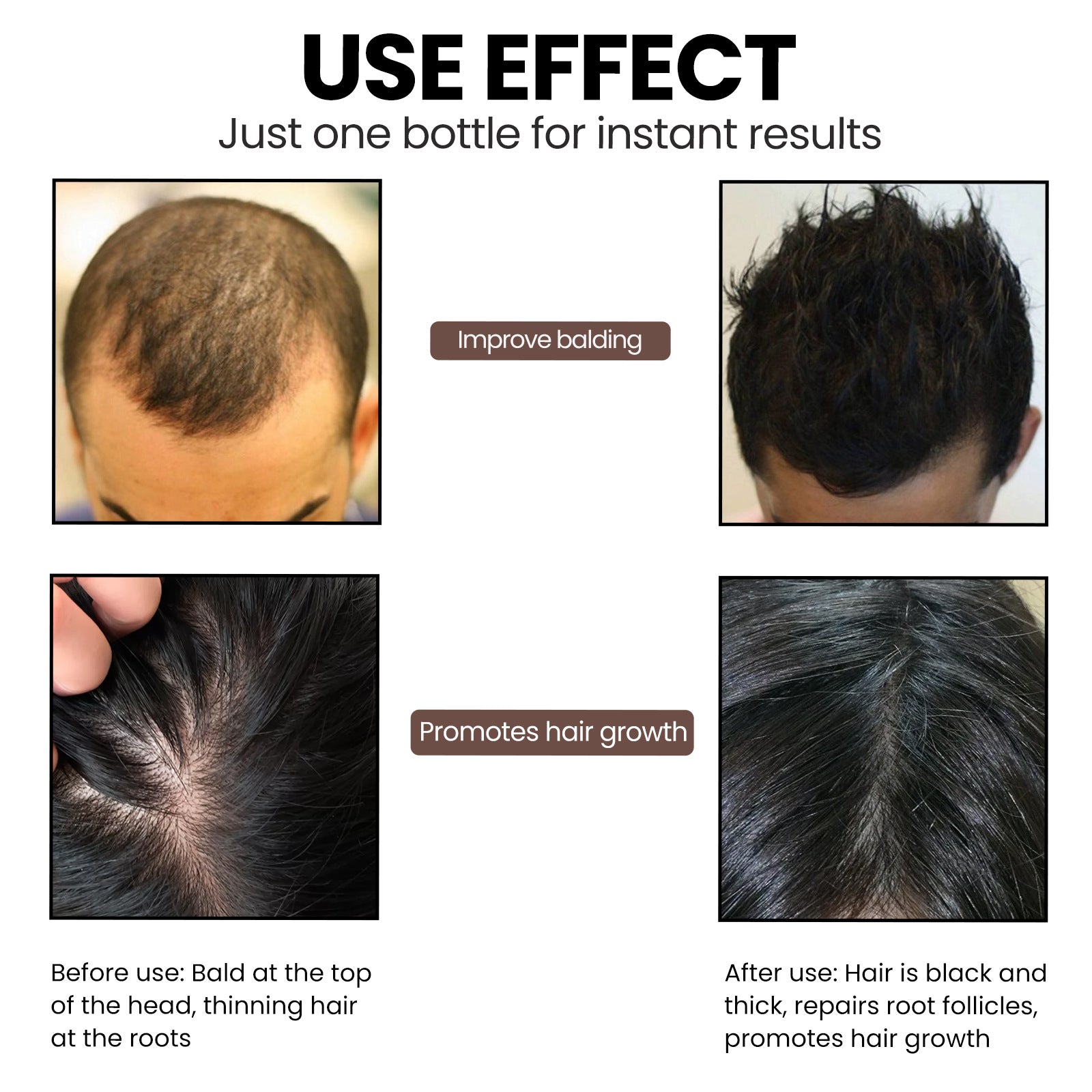 Root Revive Hair Essence by EELHOE